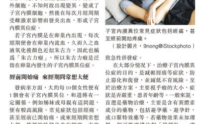 《明報副刊》報導：子宮內膜異位 嚴重可致不育