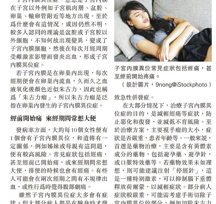 《明報副刊》報導：子宮內膜異位 嚴重可致不育