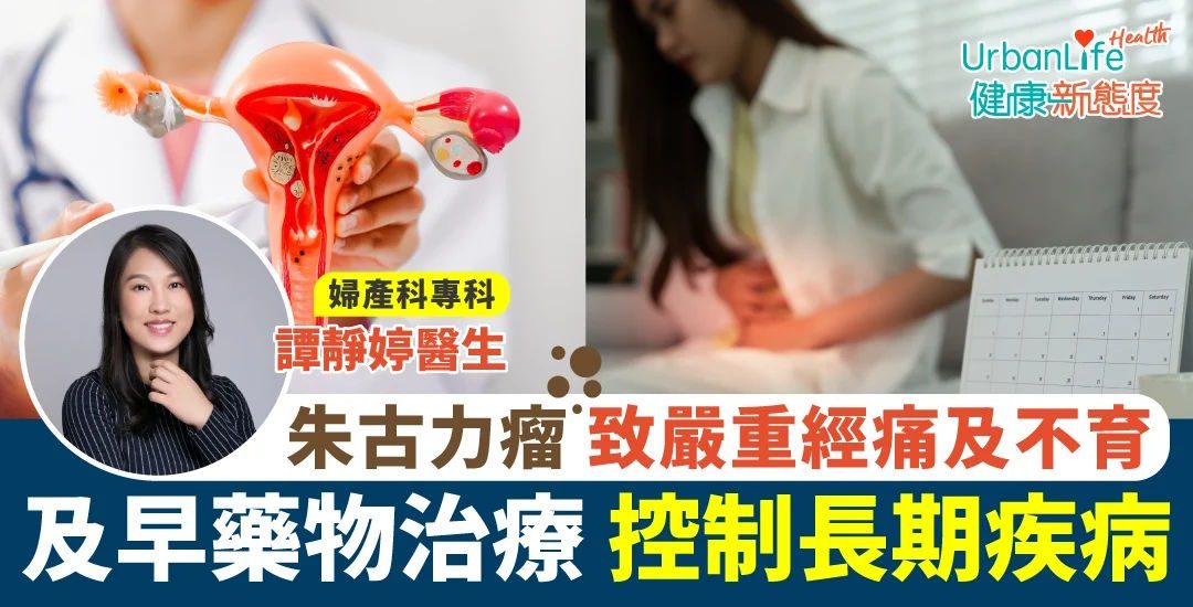 《Urban Life HK》報導：朱古力瘤致嚴重經痛及不育 及早藥物治療 控制長期疾病
